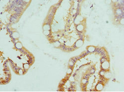 Immunohistochemistry of paraffin-embedded human small intestine tissue using CSB-PA010772ESR1HU at dilution of 1:100