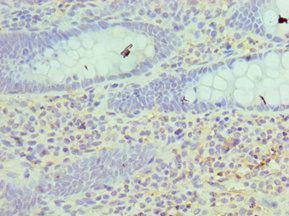 Immunohistochemistry of paraffin-embedded human epityphlon tissue using CSB-PA010774ESR1HU at dilution of 1:100