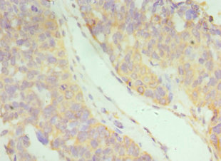CSB-PA011047ESR2HU
