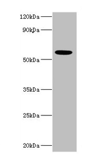CSB-PA011047ESR2HU