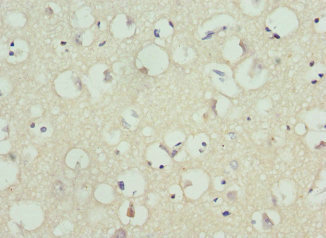 Immunohistochemistry of paraffin-embedded human brain tissue using CSB-PA012035DSR1HU at dilution of 1:100