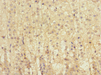 Immunohistochemistry of paraffin-embedded human adrenal gland tissue using CSB-PA013099ESR2HU at dilution of 1:100 Immunohistochemistry of paraffin-embedded human adrenal gland tissue using CSB-PA013099ESR2HU at dilution of 1:100