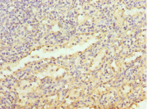 Immunohistochemistry of paraffin-embedded human spleen tissue using CSB-PA013252ESR1HU at dilution of 1:100