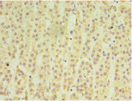 Immunohistochemistry of paraffin-embedded human adrenal gland tissue using CSB-PA013522ESR1HU at dilution of 1:100