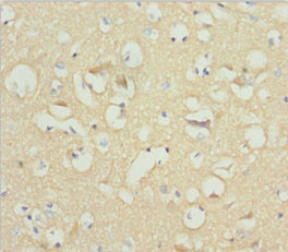 Immunohistochemistry of paraffin-embedded human brain tissue using CSB-PA015510DSR1HU at dilution of 1:100