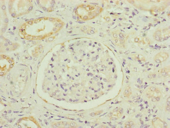 Immunohistochemistry of paraffin-embedded human kidney tissue using CSB-PA015652ESR1HU at dilution of 1:100