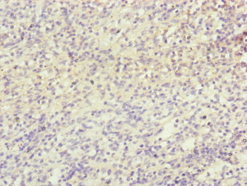 Immunohistochemistry of paraffin-embedded human spleen tissue using CSB-PA015652ESR1HU at dilution of 1:100