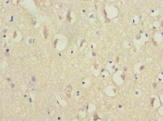 Immunohistochemistry of paraffin-embedded human brain tissue using CSB-PA015668ESR2HU at dilution of 1:100