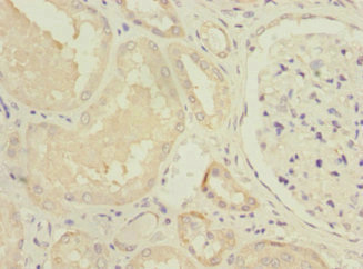 Immunohistochemistry of paraffin-embedded human kidney tissue using CSB-PA015668ESR2HU at dilution of 1:100