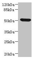 Western blot All lanes: NDUFV1 antibody at 3.46microg/ml + HepG2 whole cell lysate Secondary Goat polyclonal to rabbit IgG at 1/10000 dilution Predicted band size: 51, 50 kDa Observed band size: 51 kDa Western blot All lanes: NDUFV1 antibody at 3.46microg/ml + HepG2 whole cell lysate Secondary Goat polyclonal to rabbit IgG at 1/10000 dilution Predicted band size: 51, 50 kDa Observed band size: 51 kDa