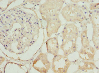 Immunohistochemistry of paraffin-embedded human kidney tissue using CSB-PA015701ESR1HU at dilution of 1:100