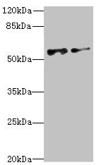 Western blot All lanes: NEK3 antibody at 6.04microg/ml Lane 1: MCF-7 whole cell lysate Lane 2: Hela whole cell lysate Secondary Goat polyclonal to rabbit IgG at 1/10000 dilution Predicted band size: 58, 56 kDa Observed band size: 58 kDa Western blot All lanes: NEK3 antibody at 6.04microg/ml Lane 1: MCF-7 whole cell lysate Lane 2: Hela whole cell lysate Secondary Goat polyclonal to rabbit IgG at 1/10000 dilution Predicted band size: 58, 56 kDa Observed band size: 58 kDa