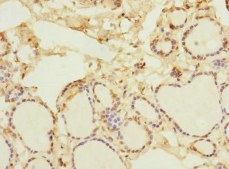 Immunohistochemistry of paraffin-embedded human thyroid tissue using CSB-PA015764ESR1HU at dilution of 1:100