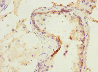 CSB-PA015901DSR1HU IHC-1