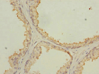 CSB-PA015901DSR1HU IHC-2