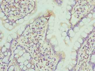 Immunohistochemistry of paraffin-embedded human small intestine tissue using CSB-PA015902ESR2HU at dilution of 1:100 Immunohistochemistry of paraffin-embedded human small intestine tissue using CSB-PA015902ESR2HU at dilution of 1:100