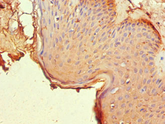 Immunohistochemistry of paraffin-embedded human skin tissue using CSB-PA016051ESR2HU at dilution of 1:100