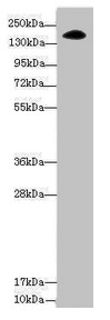 Western blot All lanes: NUP155 antibody at 3.47microg/ml + Hela whole cell lysate Secondary Goat polyclonal to rabbit IgG at 1/10000 dilution Predicted band size: 156, 150 kDa Observed band size: 156 kDa