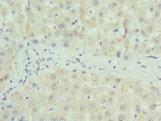 Immunohistochemistry of paraffin-embedded human liver tissue using CSB-PA017397ESR1HU at dilution of 1:100