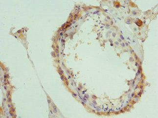 Immunohistochemistry of paraffin-embedded human testis tissue using CSB-PA017397ESR1HU at dilution of 1:100