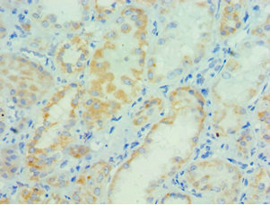 Immunohistochemistry of paraffin-embedded human kidney tissue using CSB-PA017467ESR2HU at dilution of 1:100