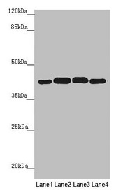Western blot All lanes: PDHA2 antibody at 1.9microg/ml Lane 1: Mouse gonadal tissue Lane 2: 293T whole cell lysate Lane 3: A549 whole cell lysate Lane 4: HepG2 whole cell lysate Secondary Goat polyclonal to rabbit IgG at 1/10000 dilution Predicted band size: 43 kDa Observed band size: 43 kDa Western blot All lanes: PDHA2 antibody at 1.9microg/ml Lane 1: Mouse gonadal tissue Lane 2: 293T whole cell lysate Lane 3: A549 whole cell lysate Lane 4: HepG2 whole cell lysate Secondary Goat polyclonal to rabbit IgG at 1/10000 dilution Predicted band size: 43 kDa Observed band size: 43 kDa