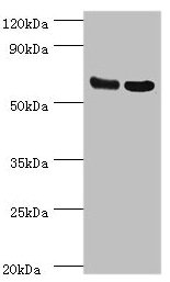 Western Blotting(WB) - PDPK1 Antibody