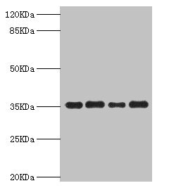 Western blot All lanes: PDXK antibody at 5.63microg/ml Lane 1: Mouse liver tissue Lane 2: Hela whole cell lysate Lane 3: Mouse kidney tissue Lane 4: HepG2 whole cell lysate Secondary Goat polyclonal to rabbit IgG at 1/10000 dilution Predicted band size: 36, 32, 27 kDa Observed band size: 36 kDa