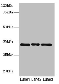 Western blot All lanes: PECR antibody at 3.27microg/ml Lane 1: MCF-7 whole cell lysate Lane 2: HepG2 whole cell lysate Lane 3: Hela whole cell lysate Secondary Goat polyclonal to rabbit IgG at 1/10000 dilution Predicted band size: 33, 17 kDa Observed band size: 33 kDa Western blot All lanes: PECR antibody at 3.27microg/ml Lane 1: MCF-7 whole cell lysate Lane 2: HepG2 whole cell lysate Lane 3: Hela whole cell lysate Secondary Goat polyclonal to rabbit IgG at 1/10000 dilution Predicted band size: 33, 17 kDa Observed band size: 33 kDa