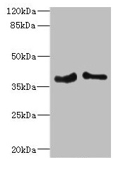 Western blot All lanes: PHF11 antibody at 4.36microg/ml Lane 1: Jurkat whole cell lysate Lane 2: Hela whole cell lysate Secondary Goat polyclonal to rabbit IgG at 1/10000 dilution Predicted band size: 38, 34 kDa Observed band size: 38 kDa