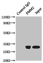 Immunoprecipitating PMM2 in Hela whole cell lysate Lane 1: Rabbit control IgG instead of (1microg) instead of CSB-PA018238ESR2HU in Hela whole cell lysate. For western blotting, a HRP-conjugated anti-rabbit IgG, specific to the non-reduced form of IgG was used as the Secondary antibody (1/50000) Lane 2: CSB-PA018238ESR2HU (4microg) + Hela whole cell lysate (500microg) Lane 3: Hela whole cell lysate (20microg)