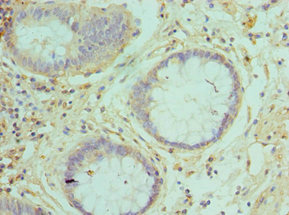 CSB-PA019213ESR1HU
