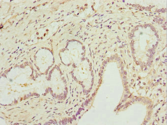 Immunohistochemistry of paraffin-embedded human pancreatic tissue using CSB-PA019215DSR2HU at dilution of 1:100 Immunohistochemistry of paraffin-embedded human pancreatic tissue using CSB-PA019215DSR2HU at dilution of 1:100