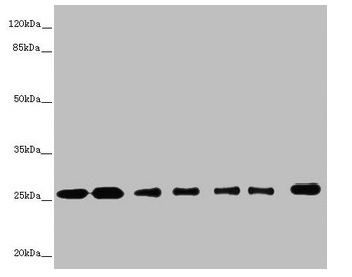 Western blot All lanes: RALB antibody at 1.26microg/ml Lane 1: Mouse brain tissue Lane 2: Mouse lung tissue Lane 3: MCF-7 whole cell lysate Lane 4: HepG2 whole cell lysate Lane 5: Jurkat whole cell lysate Lane 6: NIH/3T3 whole cell lysate Lane 7: Hela whole cell lysate Secondary Goat polyclonal to rabbit IgG at 1/10000 dilution Predicted band size: 24, 26 kDa Observed band size: 26 kDa Western blot All lanes: RALB antibody at 1.26microg/ml Lane 1: Mouse brain tissue Lane 2: Mouse lung tissue Lane 3: MCF-7 whole cell lysate Lane 4: HepG2 whole cell lysate Lane 5: Jurkat whole cell lysate Lane 6: NIH/3T3 whole cell lysate Lane 7: Hela whole cell lysate Secondary Goat polyclonal to rabbit IgG at 1/10000 dilution Predicted band size: 24, 26 kDa Observed band size: 26 kDa