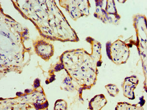 Immunohistochemistry of paraffin-embedded human placenta tissue using CSB-PA019496ESR2HU at dilution of 1:100