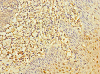 Immunohistochemistry of paraffin-embedded human tonsil tissue using CSB-PA019642ESR1HU at dilution of 1:100 Immunohistochemistry of paraffin-embedded human tonsil tissue using CSB-PA019642ESR1HU at dilution of 1:100
