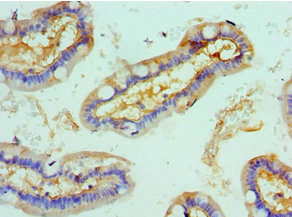 Immunohistochemistry of paraffin-embedded human small intestine tissue using CSB-PA020059ESR1HU at dilution of 1:100
