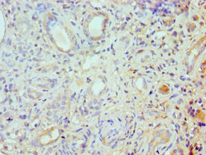 Immunohistochemistry of paraffin-embedded human kidney tissue using CSB-PA020059ESR1HU at dilution of 1:100
