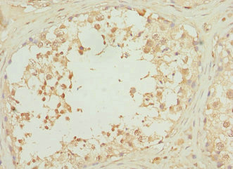 Immunohistochemistry of paraffin-embedded human testis tissue using CSB-PA020474ESR1HU at dilution of 1:100