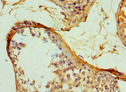 Immunohistochemistry of paraffin-embedded human testis tissue using CSB-PA021087ESR2HU at dilution of 1:100