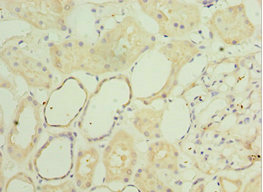 Immunohistochemistry of paraffin-embedded human kidney tissue using CSB-PA021200ESR1HU at dilution of 1:100 Immunohistochemistry of paraffin-embedded human kidney tissue using CSB-PA021200ESR1HU at dilution of 1:100