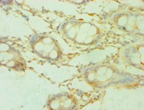 Immunohistochemistry of paraffin-embedded human colon tissue using CSB-PA021272ESR1HU at dilution of 1:100