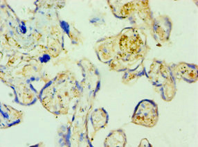 Immunohistochemistry of paraffin-embedded human placenta tissue using CSB-PA021272ESR1HU at dilution of 1:100