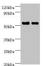 Western blot All lanes: SHMT1 antibody at 7microg/ml Lane 1: Hela whole cell lysate Lane 2: HepG2 whole cell lysate Secondary Goat polyclonal to rabbit IgG at 1/10000 dilution Predicted band size: 54, 50, 45, 38 kDa Observed band size: 54 kDa