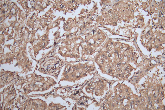 Immunohistochemistry of paraffin-embedded human epityphlon tissue using CSB-PA021369ESR2HU at dilution of 1:100