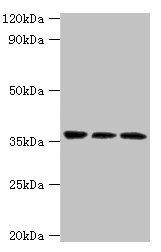 Western blot All lanes: SLAMF7 antibody at 3microg/ml Lane 1: Jurkat whole cell lysate Lane 2: K562 whole cell lysate Lane 3: Mouse spleen tissue Secondary Goat polyclonal to rabbit IgG at 1/10000 dilution Predicted band size: 38, 26, 18, 33, 23, 22 kDa Observed band size: 38 kDa Western blot All lanes: SLAMF7 antibody at 3microg/ml Lane 1: Jurkat whole cell lysate Lane 2: K562 whole cell lysate Lane 3: Mouse spleen tissue Secondary Goat polyclonal to rabbit IgG at 1/10000 dilution Predicted band size: 38, 26, 18, 33, 23, 22 kDa Observed band size: 38 kDa
