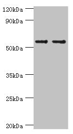 Western blot All lanes: SLC2A1 antibody at 6microg/ml Lane 1: NIH/3T3 whole cell lysate Lane 2: Hela whole cell lysate Secondary Goat polyclonal to rabbit IgG at 1/10000 dilution Predicted band size: 54 kDa Observed band size: 54 kDa Western blot All lanes: SLC2A1 antibody at 6microg/ml Lane 1: NIH/3T3 whole cell lysate Lane 2: Hela whole cell lysate Secondary Goat polyclonal to rabbit IgG at 1/10000 dilution Predicted band size: 54 kDa Observed band size: 54 kDa