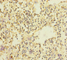 Immunohistochemistry of paraffin-embedded human spleen tissue using CSB-PA021583ESR1HU at dilution of 1:100 Immunohistochemistry of paraffin-embedded human spleen tissue using CSB-PA021583ESR1HU at dilution of 1:100