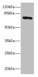 Western blot All lanes: SLCO2B1 antibody at 1.5microg/ml + HepG2 whole cell lysate Secondary Goat polyclonal to rabbit IgG at 1/10000 dilution Predicted band size: 77, 53, 75, 62 kDa Observed band size: 77 kDa Western blot All lanes: SLCO2B1 antibody at 1.5microg/ml + HepG2 whole cell lysate Secondary Goat polyclonal to rabbit IgG at 1/10000 dilution Predicted band size: 77, 53, 75, 62 kDa Observed band size: 77 kDa
