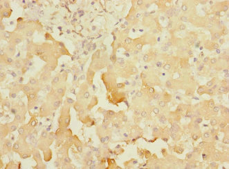 Immunohistochemistry of paraffin-embedded human liver tissue using CSB-PA022386ESR1HU at dilution of 1:100 Immunohistochemistry of paraffin-embedded human liver tissue using CSB-PA022386ESR1HU at dilution of 1:100